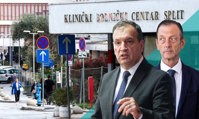Između ravnatelja splitskog KBC-a i ministra zdravstva sve su jače tenzije
