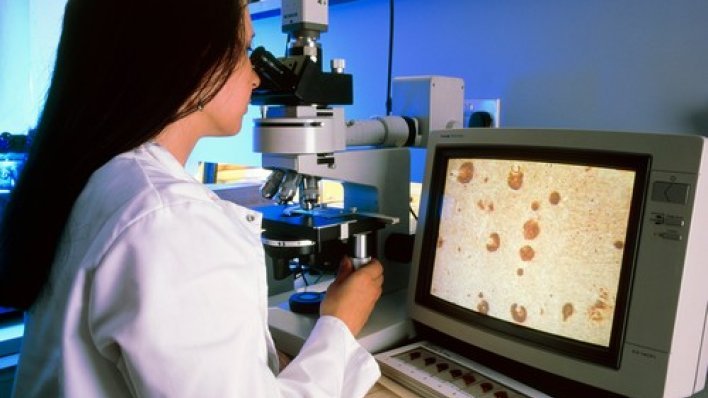 Znanstvenici otkrili neočekivanu pomoć protiv Alzheimera: Jeftina i sigurna aminokiselina