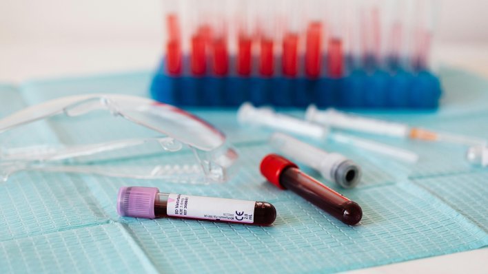 Novo otkriće: Jednostavan test otkriva više od 50 vrsta raka u ranoj fazi