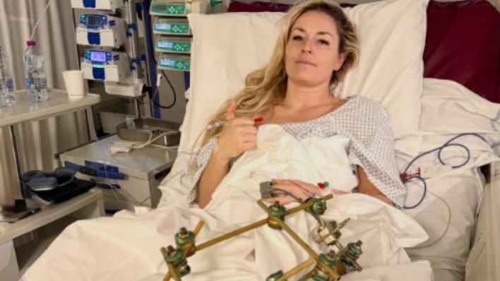 Lindsey Vonn objavila prvu fotografiju nakon stravične nesreće na Igrama