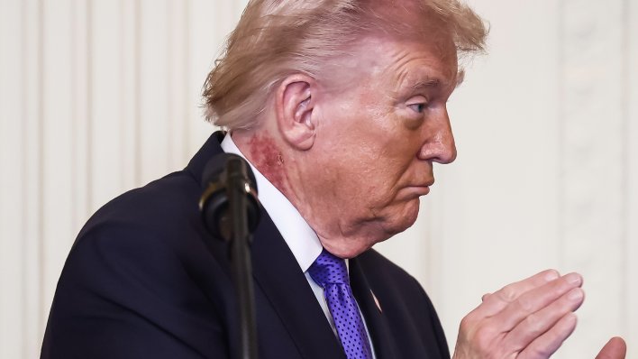 Svi se pitaju: Misteriozni osip na Trumpovom vratu pokrenuo val nagađanja