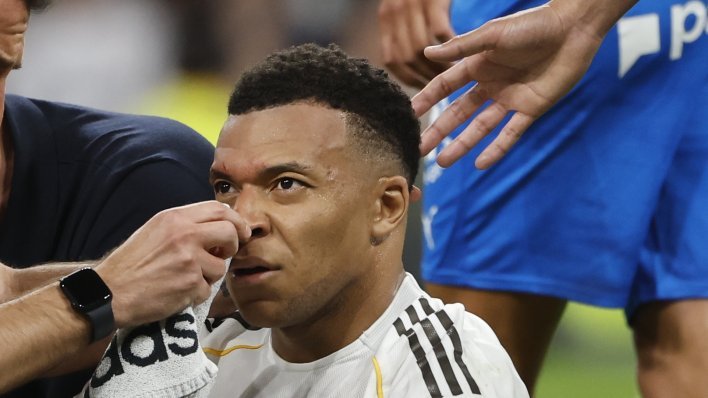 Mbappe objavio fotografiju glave: Pogledajte ozljedu za koju nije dobio penal