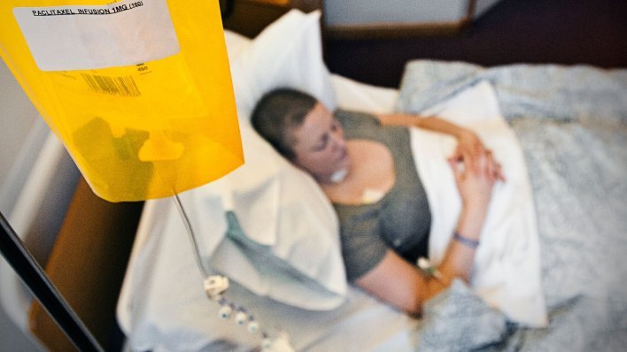 'Zaboravljeni rak' koji u Hrvatskoj odnosi sve više života i dalje se prekasno otkriva