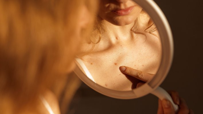 Znanstvenici s Ruđera došli do važnog otkrića o širenju melanoma
