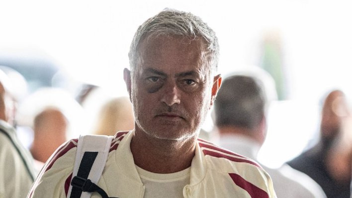 Jose Mourinho šokirao izgledom: Velika modrica ispod oka zabrinula je sve