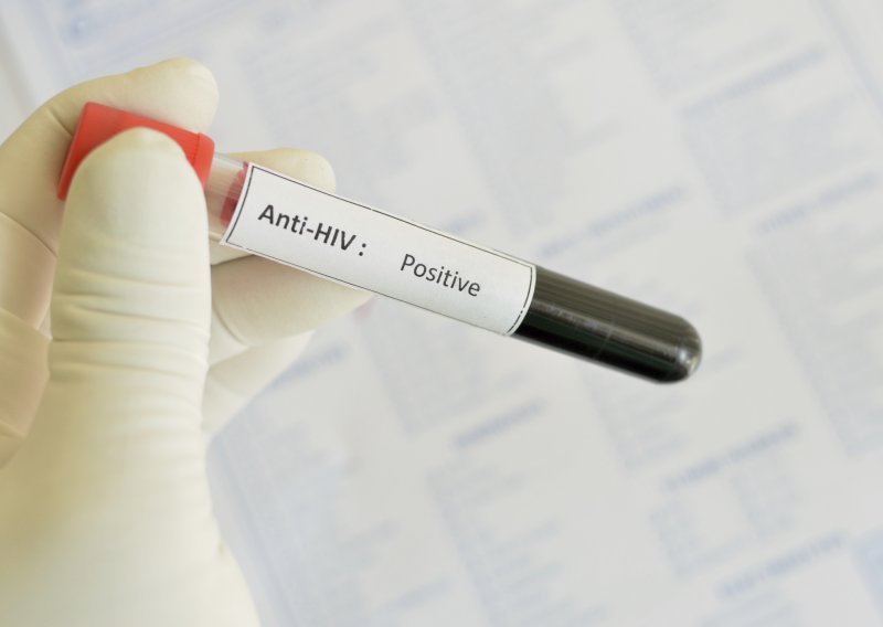 Francuski znanstvenici otkrili molekulu koja paralizira HIV