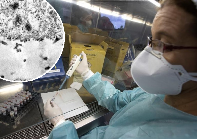 Znanstvenici usnimili trenutak u kojem koronavirus inficira stanicu. Pogledajte kako to izgleda
