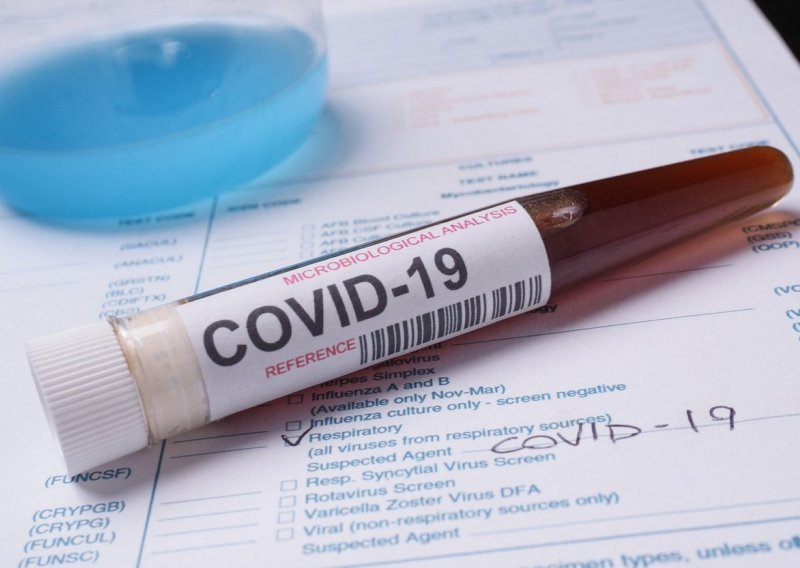 Njemačka vlada kupuje udio u tvrtki koja razvija cjepivo za Covid-19