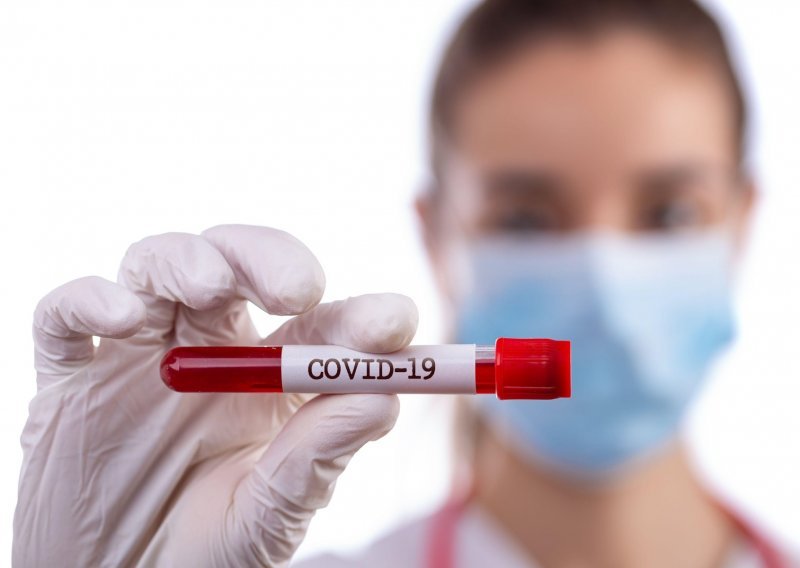 Rizik od koronavirusa 45 posto je veći kod onih koji imaju krvnu grupu A