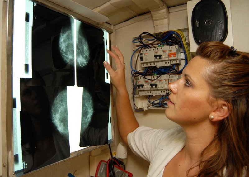'Ukidanje mamografija je notorna ludost'