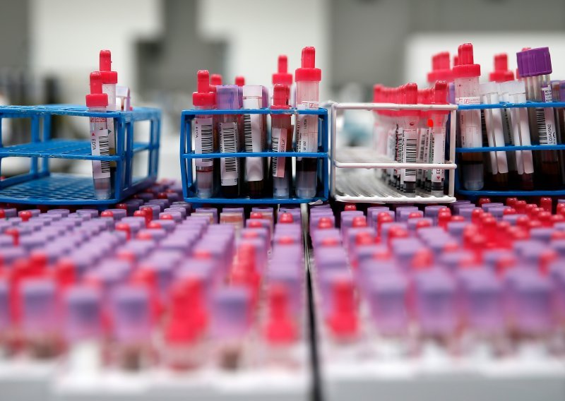Virovitičko-podravska županija nabavlja PCR uređaj za brže otkrivanje covida-19