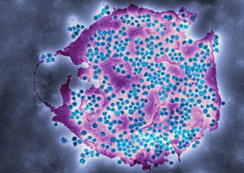Uspjeh znanstvenika: Otkrili kako virus manipulira stanicama da bi se replicirao