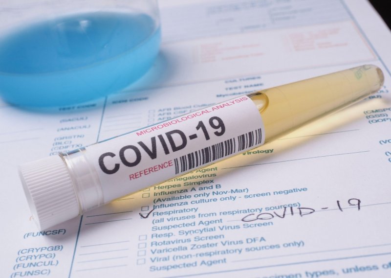EU traži od WHO-a promjene u upravljanju epidemijom koronavirusa