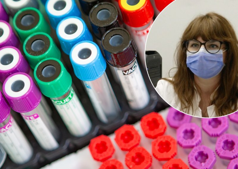 Cijepili ste se i želite znati imate li i koliko protutijela? Stručnjakinja otkriva sve o testovima, ali i upozorava: Ako imate protutijela, to ne znači da ste zaštićeni