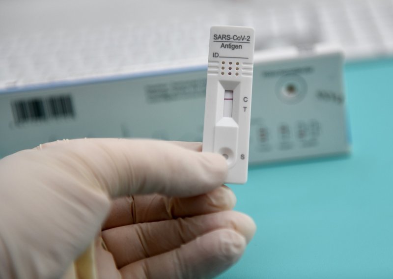 U Hrvatsku stiglo prvih 10.000 testova za samotestiranje na koronavirus; poznato je i kolika će mu biti cijena
