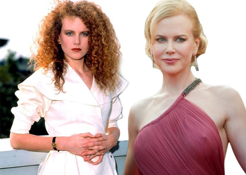 Što su godine učinile licu Nicole Kidman