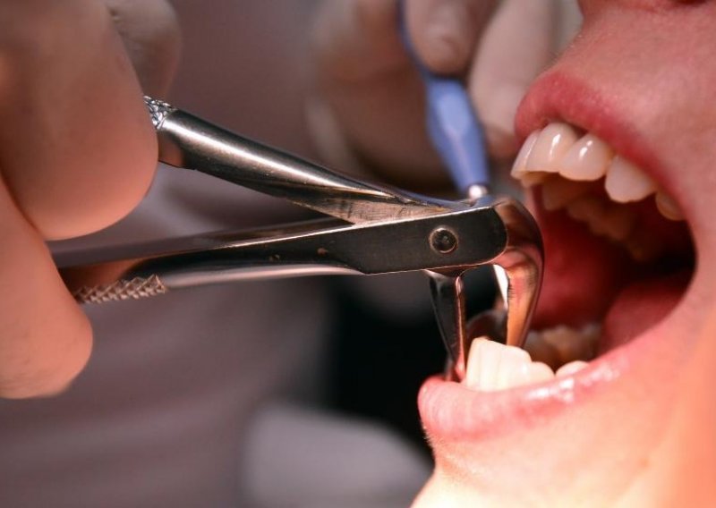 Kvarnerske zubare posjeti 50.000 stranaca na godinu