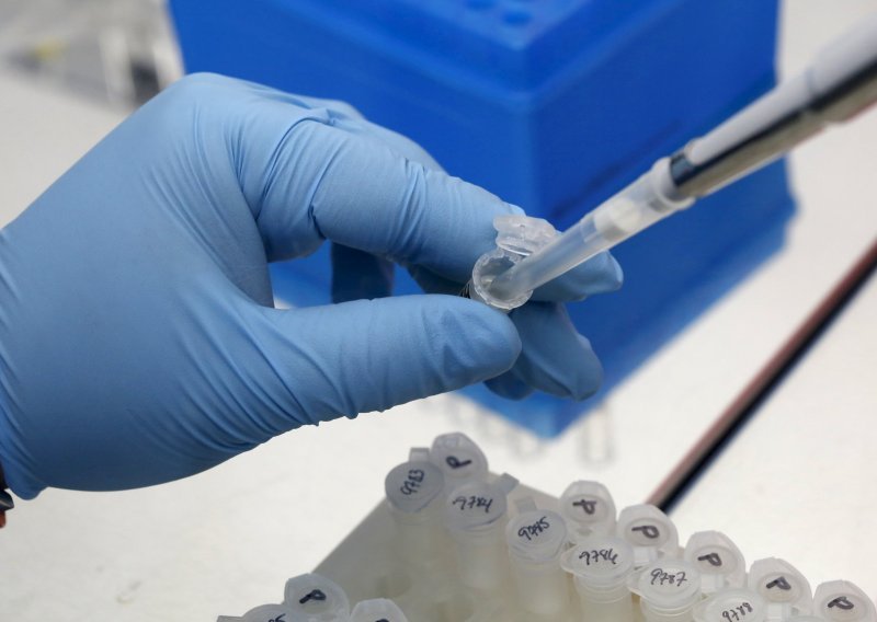 Slovenski znanstvenici dokazali povezanost bolesti zike s oštećenjem mozga