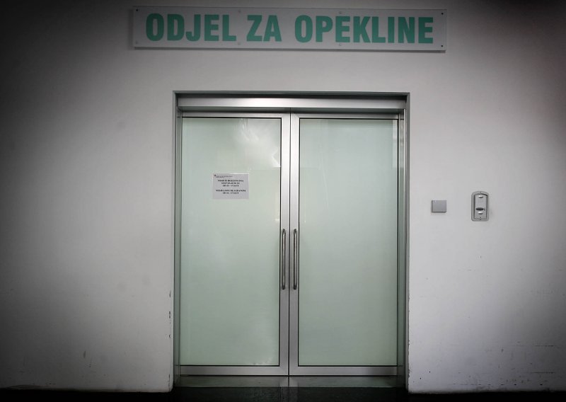 Opečeni električar i dalje kritično