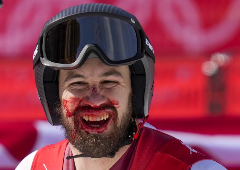 [FOTO] Kakav olimpijski duh! Za vrijeme utrke unakazio si je lice, nije mogao disati od krvi, ali nije odustao...