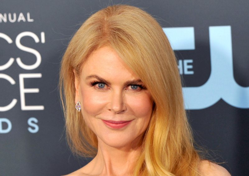 Obožavatelji je ovoga puta nisu štedjeli: Društvene mreže gore zbog Nicole Kidman i lošeg fotošopa