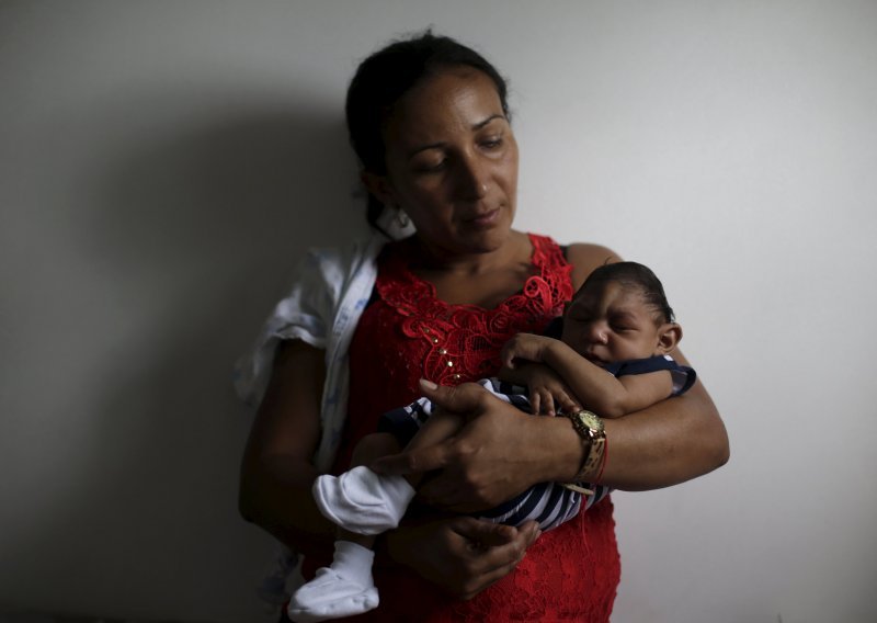 Brazil: 641 bebe oboljele od mikrocefalije, 139 umrlih
