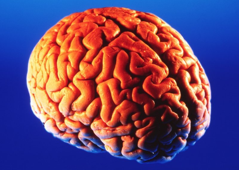 Nova studija: Covid može prouzročiti smanjenje moždane mase i sive tvari