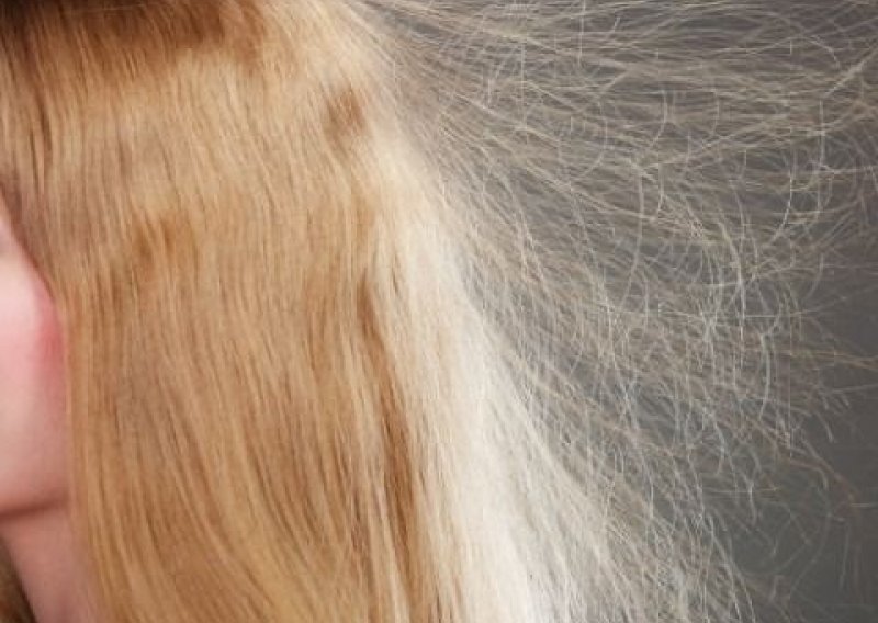 Mučite se s naelektriziranom kosom? Isprobajte ovaj trik s aluminijskom folijom i u trenu imate frizuru kao iz salona