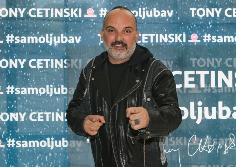 Tony Cetinski ispričao sve o transplantaciji kose: 'Svaki put je bolno, no idem do kraja...'