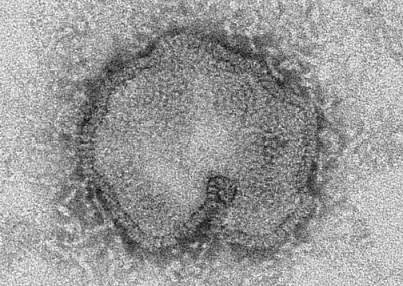 Novi ubojiti virus gripe iznenadio otpornošću na lijekove
