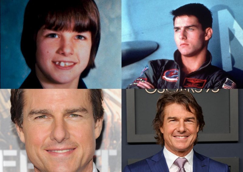 Kako se tijekom godina mijenjao Tom Cruise: Posezao je za raznim zahvatima i tretmanima samo da bi ostao vječno mlad