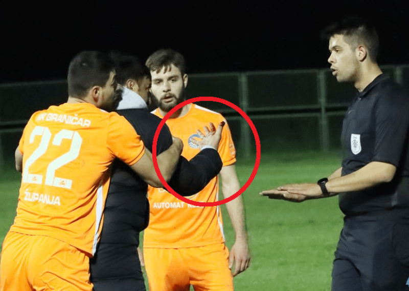 Treneru Čepina protivnički je fizio odgrizao komad prsta: Poludio sam nakon što me ugrizao