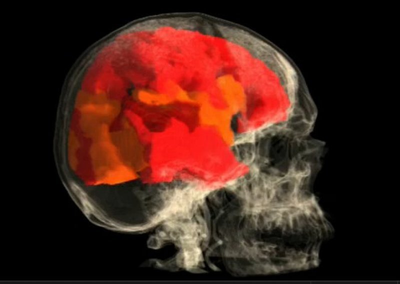Pogledajte kako ženski mozak izgleda za vrijeme orgazma