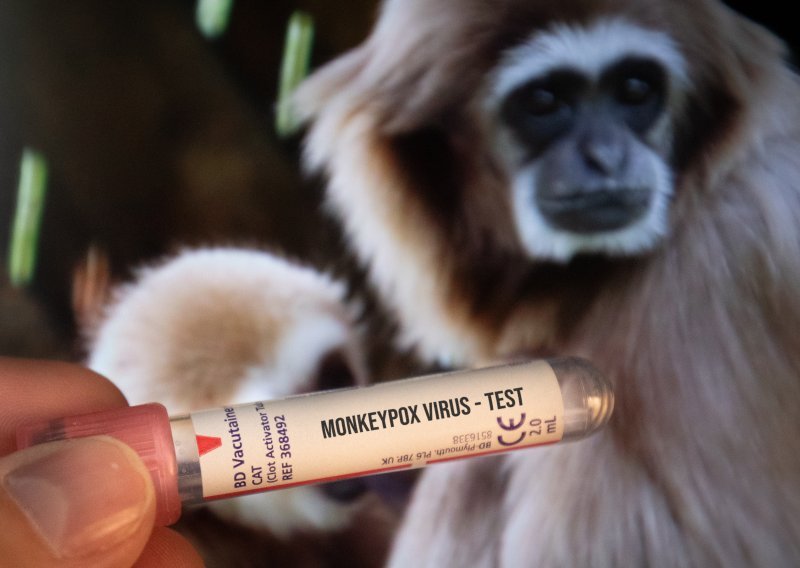 WHO: Majmunske boginje više nisu globalna zdravstvena prijetnja