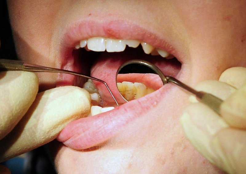 Što kažete na lijek koji bi omogućio da nam izrastu potpuno novi zubi?