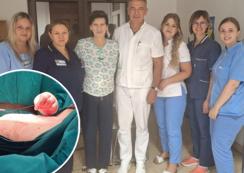 U Gospiću izvadili tumor težak 20 kilograma: 'Pacijentica je mislila da se deblja'