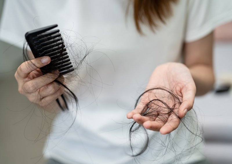 Muči li vas ispadanje kose? Predstavljamo vam inovativnu formulu i zaštitu od ispadanja!