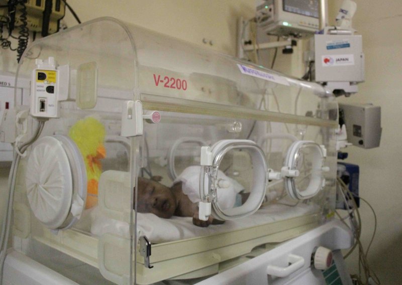 Sedamdesetogodišnjakinja iz Ugande rodila blizance