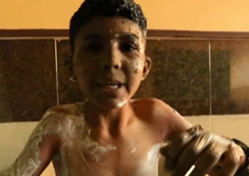 UN potvrdio: U Siriji su civili pobijeni sarinom