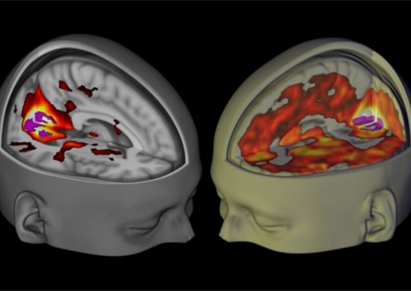 Snimke otkrivaju tajne djelovanja LSD-ja