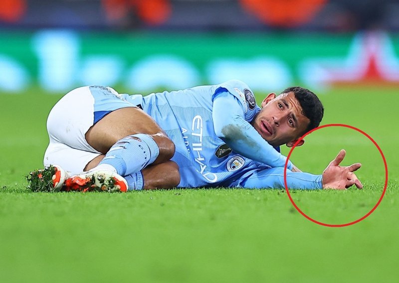 Veznjak Manchester Cityja slomio prst, scena je šokirala sve na terenu