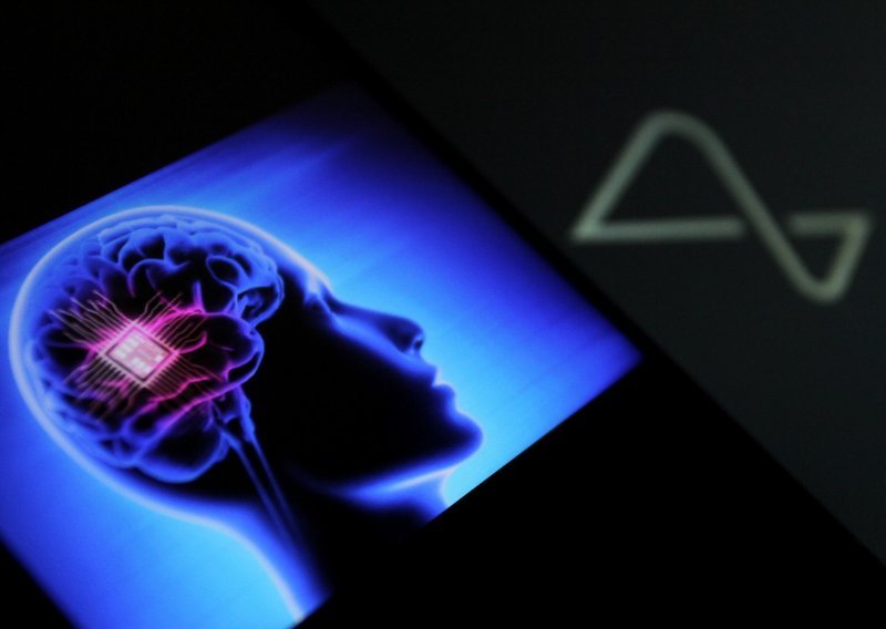 Neuralink: 'Pokvario se dio moždanog implantata u našem prvom pacijentu'