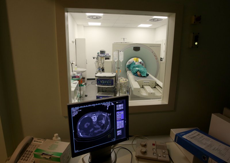 Jeziv broj mladih ljudi dobije jednu od ove 3 vrste raka: Evo kako se zaštititi