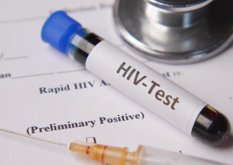 Hrvatska lani imala više od 2000 oboljelih od HIV/AIDS-a: Ovo su najčešće spolne bolesti