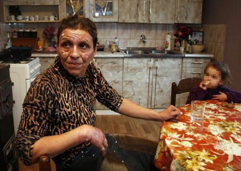 U eksploziji plina stradala romska obitelj