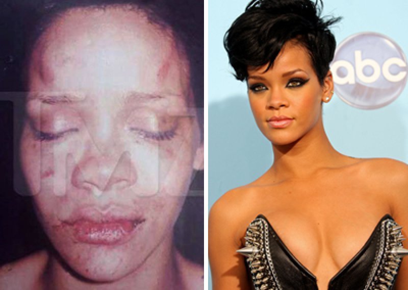 Rihanna ne želi komentirati napad