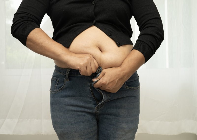 Za pretilost je potrebna nova definicija: BMI ne otkriva ništa o pacijentovu sveukupnom zdravlju