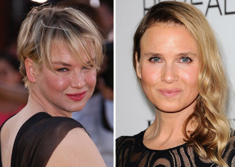 Renee Zellweger odgovorila kritičarima svog lica