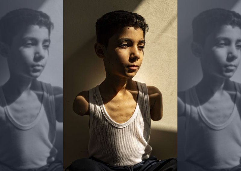 Najbolja novinska fotografija u svijetu prikazuje palestinskog dječaka koji je ostao bez obje ruke u ratu u Gazi