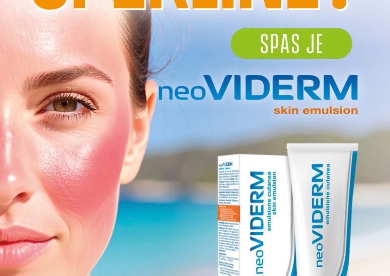 Svi bi trebali imati neoVIDERM emulziju u kućnoj ljekarni